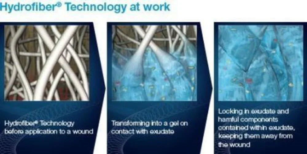 Aquacel AG 5cm x 5cm Silver Hydrofiber Wound Dressing x10 S7505AG - Convatec EasyMeds Pharmacy