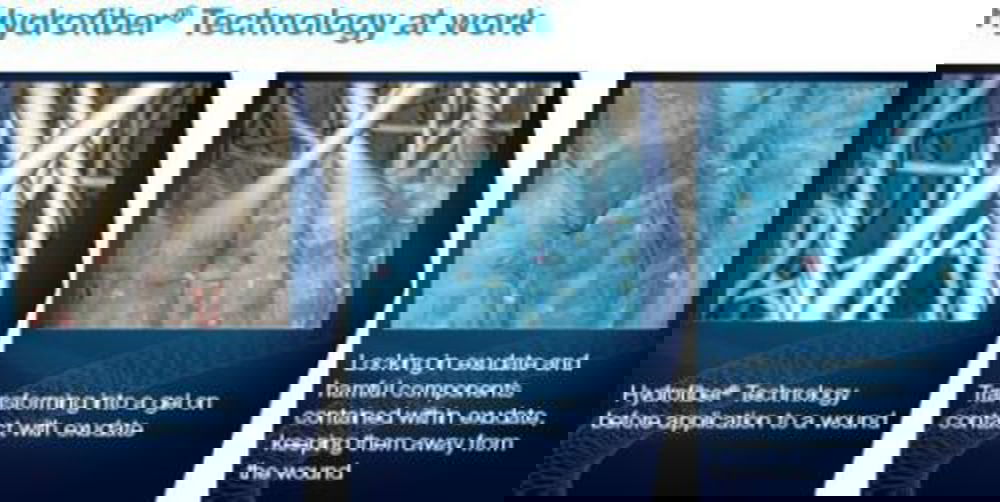 Aquacel AG Silver Hydrofiber Ribbon Dressing 2 x 45cm x5 S7509AG -   Convatec EasyMeds Pharmacy