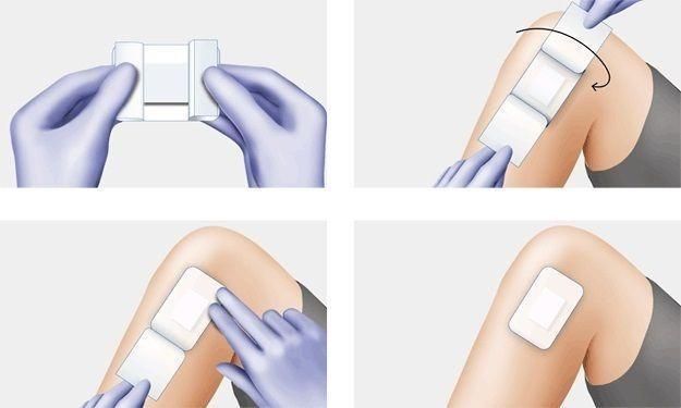 Cosmopor E Sterile Adhesive Wound Dressings 15cm x 8cm x 25 Surgical Cuts Burns -   Hartmann EasyMeds Pharmacy