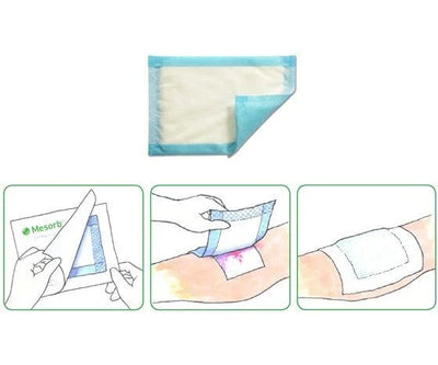 Types of wound dressings - EasyMeds Pharmacy