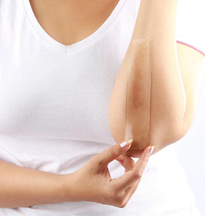 Scar Treatment - EasyMeds Pharmacy