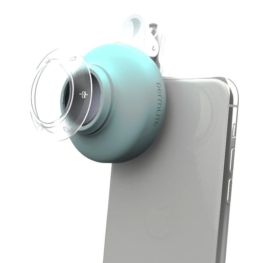 3Gen DermLite HUD2 HUD2 Smartphone based Patient Dermatoscope (DE-L-HUD2) 7-10 Day Dispatch -   Dermlite EasyMeds Pharmacy