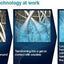 Aquacel AG+ Extra Silver Hydrofiber Wound Dressing 5cm x 5cm x10 -   Convatec EasyMeds Pharmacy