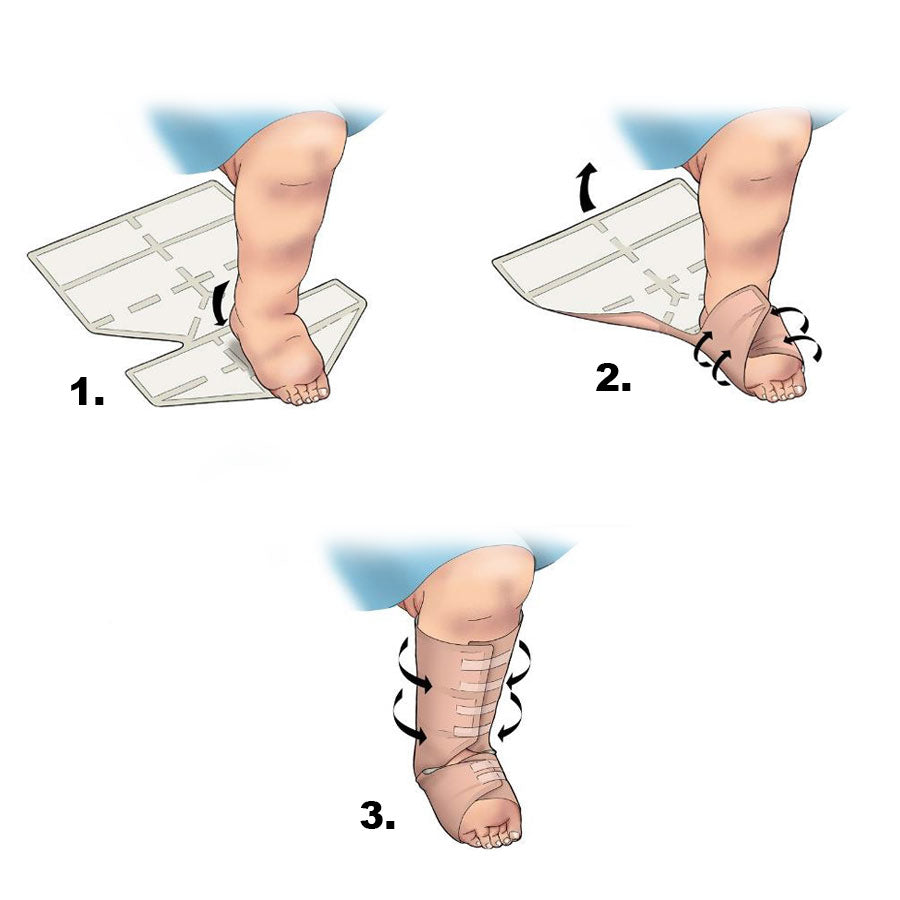 Eclypse Boot Super Absorbent Dressing 60cm x 70cm -   Advancis Medical EasyMeds Pharmacy