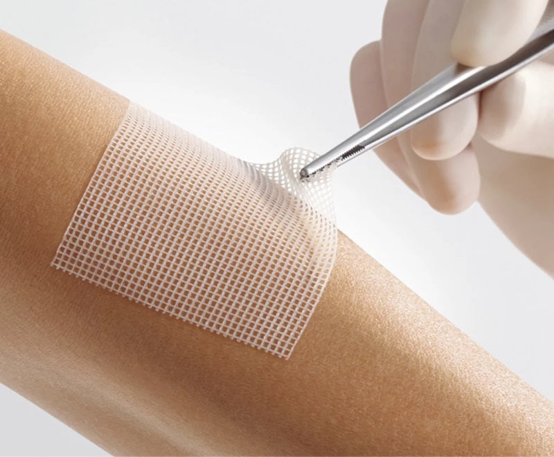 Lomatuell Pro Gelling Contact Net Wound Dressing 5cm x 5cm x 10