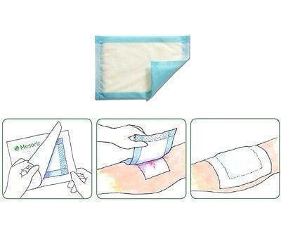Mesorb Cellulose Absorbent Dressings 10cm x 15cm x10 - Highly Absorbant -   Molnlycke EasyMeds Pharmacy